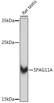 Western blot analysis of extracts of Rat testis using SPAG11A Polyclonal Antibody at 1:1000 dilution.