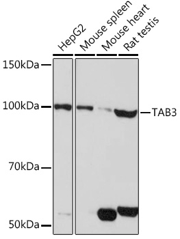 Western blot analysis of extracts of various cell lines using TAB3 pAb Polyclonal Antibody at1:1000 dilution.