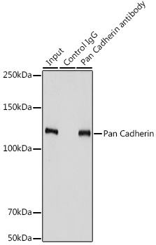 Immunoprecipitation analysis of 900ug extracts of PC-3 cells using 3ug Pan Cadherin Polyclonal Antibody.Western blot was performed from the immunoprecipitate using Pan Cadherin Polyclonal Antibody at a dilution of 1:3000.