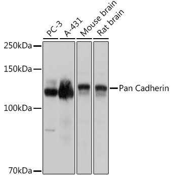 Western blot analysis of extracts of various cell lines using Pan Cadherin Polyclonal Antibody at 1:3000 dilution.