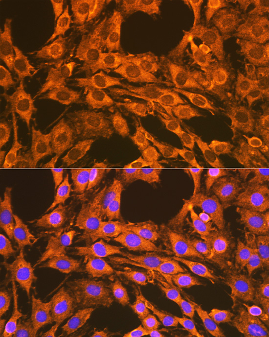 Immunofluorescence analysis of C6 cells using VDAC2 Polyclonal Antibody at dilution of 1:100 (40x lens). Blue: DAPI for nuclear staining.