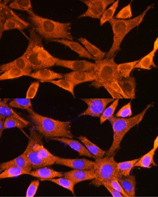 Immunofluorescence analysis of NIH-3T3 cells using VDAC2 Polyclonal Antibody at dilution of 1:100 (40x lens). Blue: DAPI for nuclear staining.