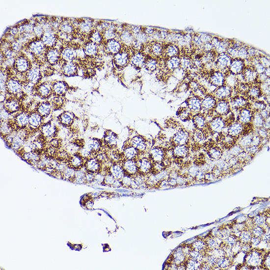 Immunohistochemistry of paraffin-embedded mouse testis using VDAC2 Polyclonal Antibody at dilution of 1:100 (40x lens).Perform high pressure antigen retrieval with 10 mM citrate buffer pH 6.0 before commencing with IHC staining protocol.