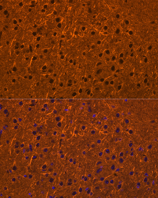 Immunofluorescence analysis of mouse brain cells using ATP2B1 Polyclonal Antibody at dilution of 1:100 (40x lens). Blue: DAPI for nuclear staining.