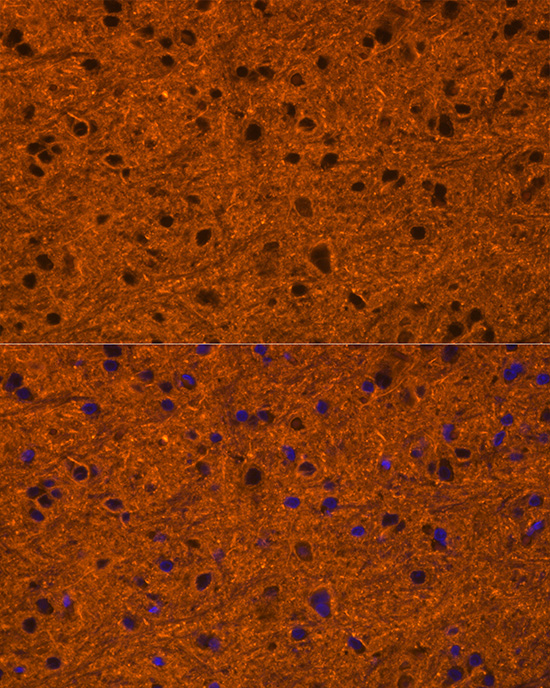 Immunofluorescence analysis of rat brain cells using ATP2B1 Polyclonal Antibody at dilution of 1:100 (40x lens). Blue: DAPI for nuclear staining.