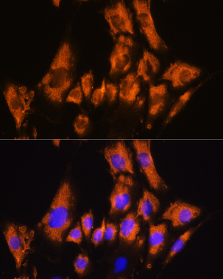 Immunofluorescence analysis of C6 cells using CDH8 Polyclonal Antibody at dilution of 1:100. Blue: DAPI for nuclear staining.