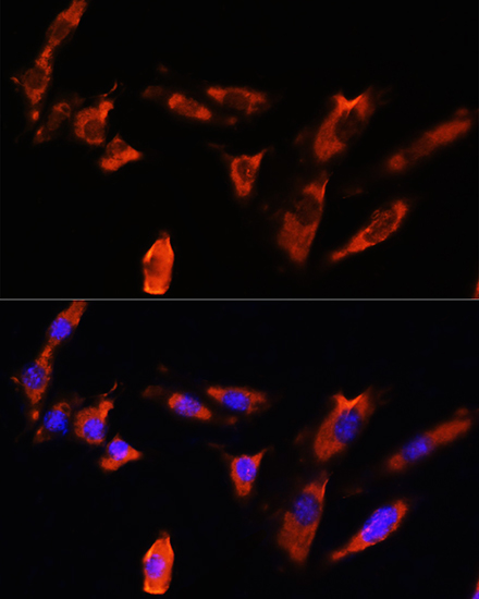 Immunofluorescence analysis of NIH/3T3 cells using CDH8 Polyclonal Antibody at dilution of 1:100. Blue: DAPI for nuclear staining.