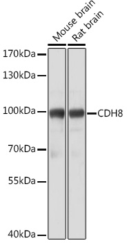 Western blot analysis of extracts of various cell lines using CDH8 Polyclonal Antibody at1:3000 dilution.