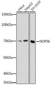 Western blot analysis of extracts of various cell lines using NOP56 Polyclonal Antibody at1:1000 dilution.