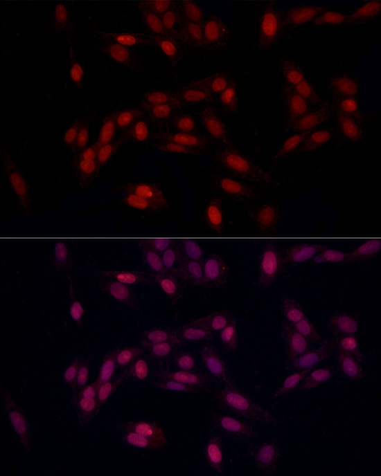 Immunofluorescence analysis of U2OS using SUPT16H Polyclonal Antibody at dilution of 1:100 (40x lens). Blue: DAPI for nuclear staining.