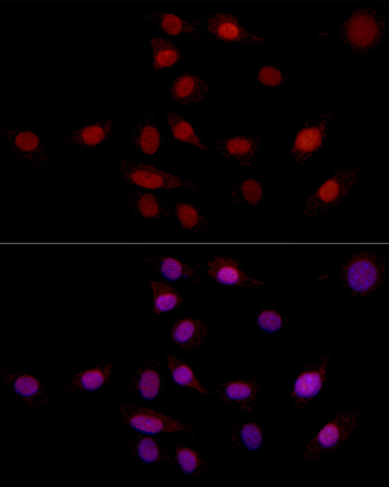 Immunofluorescence analysis of NIH/3T3 using SUPT16H Polyclonal Antibody at dilution of 1:100 (40x lens). Blue: DAPI for nuclear staining.