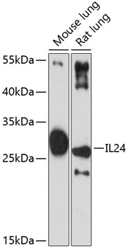Western blot analysis of extracts of various cell lines using IL24 Polyclonal Antibody at 1:3000 dilution.