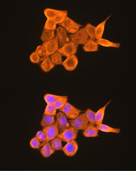 Immunofluorescence analysis of HeLa cells using PKM2-specific Polyclonal Antibody at dilution of 1:100 (40x lens). Blue: DAPI for nuclear staining.