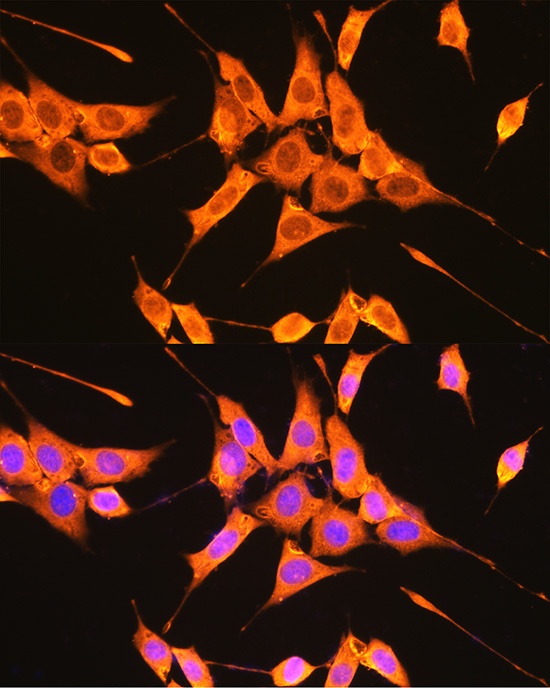 Immunofluorescence analysis of NIH-3T3 cells using PKM2-specific Polyclonal Antibody at dilution of 1:100 (40x lens). Blue: DAPI for nuclear staining.