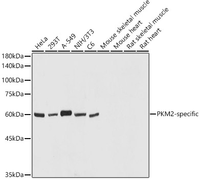 Western blot analysis of extracts of various cell lines using PKM2-specific Polyclonal Antibody at 1:1000 dilution.