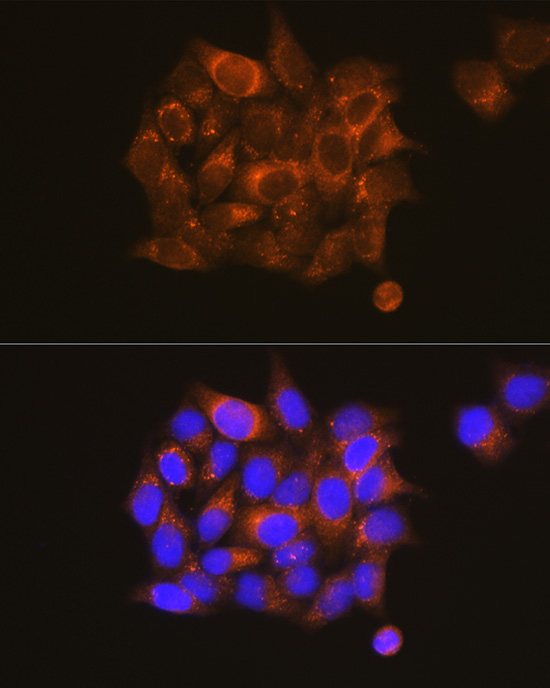 Immunofluorescence analysis of HeLa cells using PKM1-specific Polyclonal Antibody at dilution of 1:100 (40x lens). Blue: DAPI for nuclear staining.