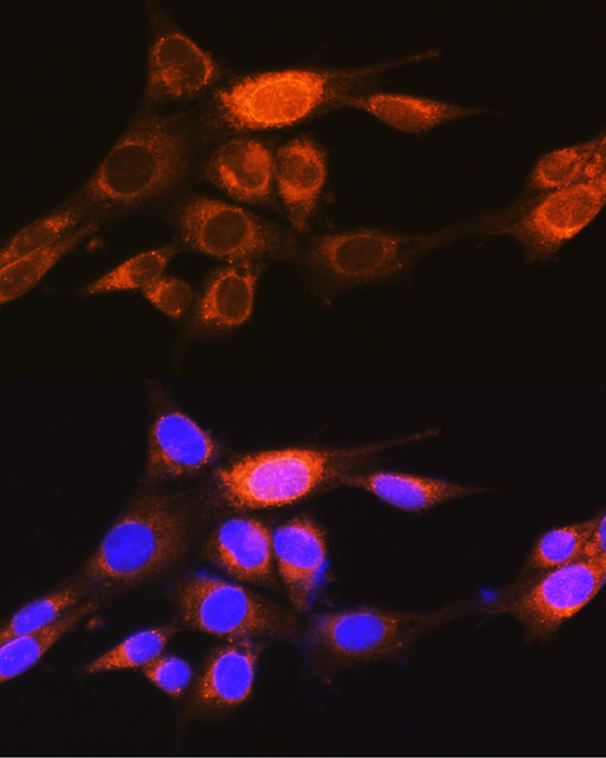 Immunofluorescence analysis of NIH/3T3 cells using PKM1-specific Polyclonal Antibody at dilution of 1:100 (40x lens). Blue: DAPI for nuclear staining.