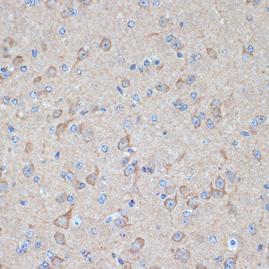 Immunohistochemistry of paraffin-embedded mouse brain using PKM1-specific Polyclonal Antibody at dilution of 1:100 (40x lens).Perform microwave antigen retrieval with 10 mM Tris/EDTA buffer pH 9.0 before commencing with IHC staining protocol.