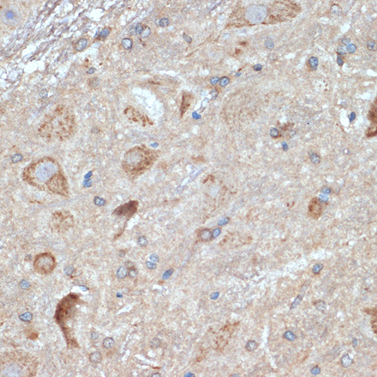 Immunohistochemistry of paraffin-embedded rat brain using PKM1-specific Polyclonal Antibody at dilution of 1:100 (40x lens).Perform microwave antigen retrieval with 10 mM Tris/EDTA buffer pH 9.0 before commencing with IHC staining protocol.