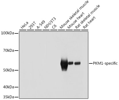 Western blot analysis of extracts of various cell lines using PKM1-specific Polyclonal Antibody at 1:1000 dilution.