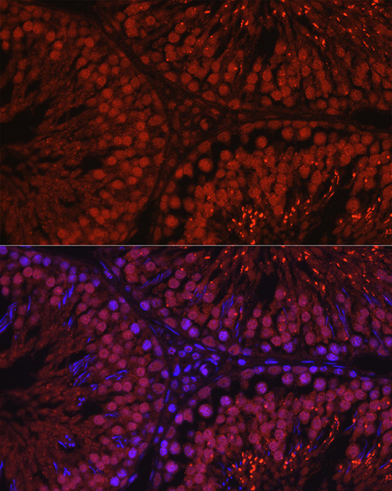 Immunofluorescence analysis of rat testis using C1orf146 Polyclonal Antibody at dilution of 1:100 (40x lens). Blue: DAPI for nuclear staining.