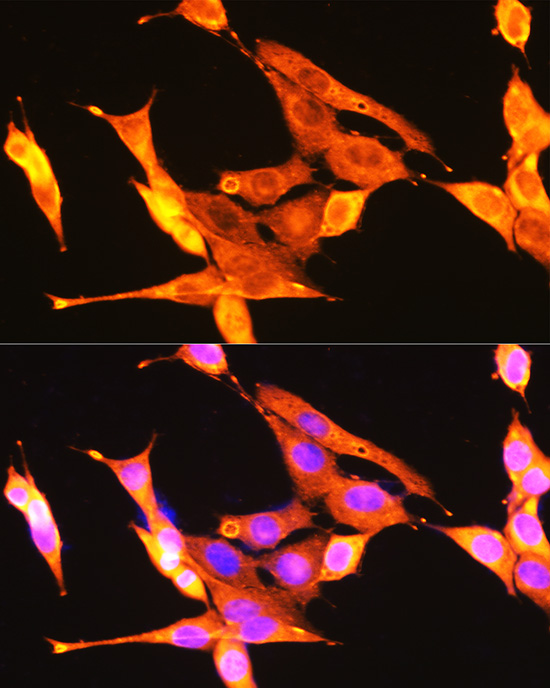 Immunofluorescence analysis of NIH-3T3 cells using NTRK1/NTRK2/NTRK3 Polyclonal Antibody at dilution of 1:100 (40x lens). Blue: DAPI for nuclear staining.