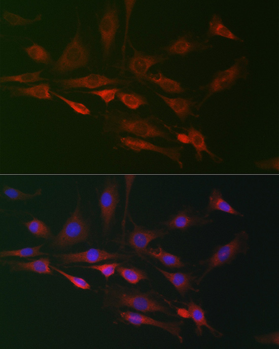 Immunofluorescence analysis of C6 cells using FAM160B2 Polyclonal Antibody at dilution of 1:100 (40x lens). Blue: DAPI for nuclear staining.