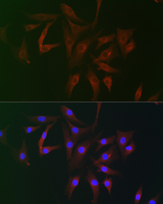 Immunofluorescence analysis of NIH/3T3 cells using FAM160B2 Polyclonal Antibody at dilution of 1:100 (40x lens). Blue: DAPI for nuclear staining.