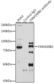 Immunoprecipitation analysis of 600ug extracts of Rat testis cells using 3ug FAM160B2 Polyclonal Antibody. Western blot was performed from the immunoprecipitate using FAM160B2 Polyclonal Antibody at a dilution of 1:1000.