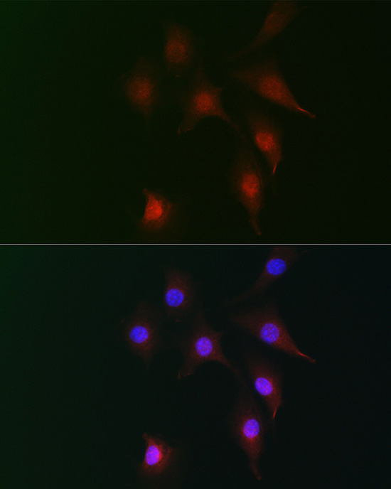 Immunofluorescence analysis of NIH-3T3 cells using FAM160B2 Polyclonal Antibody at dilution of 1:100 (40x lens). Blue: DAPI for nuclear staining.