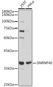 Western blot analysis of extracts of various cell lines using SNRNP40 Polyclonal Antibody at 1:1000 dilution.