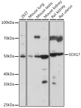 Western blot analysis of extracts of various cell lines using SOX17 Polyclonal Antibody at 1:1000 dilution.