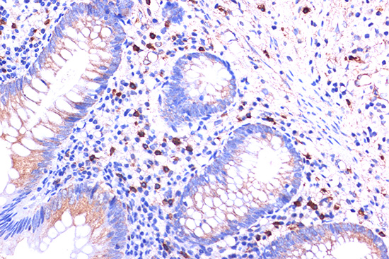 Immunohistochemistry of paraffin-embedded human appendix using C5AR1 Polyclonal Antibody at dilution of 1:100 (40x lens).Perform microwave antigen retrieval with 10 mM PBS buffer pH 7.2 before commencing with IHC staining protocol.