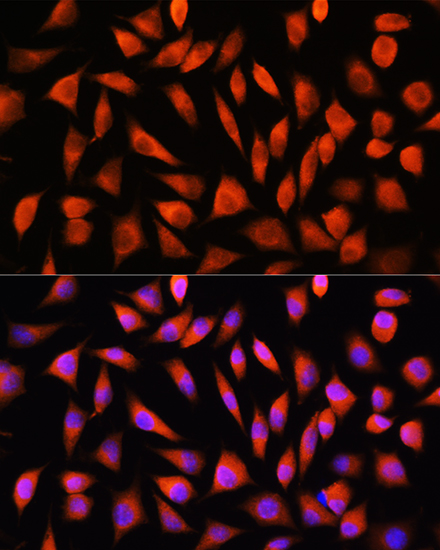 Immunofluorescence analysis of L929 cells using RHOG Polyclonal Antibody at dilution of 1:100. Blue: DAPI for nuclear staining.