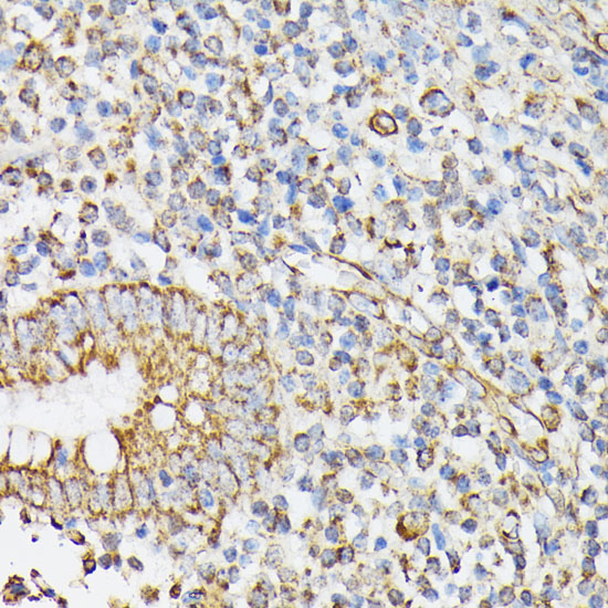 Immunohistochemistry of paraffin-embedded human appendix using RHOG Polyclonal Antibody at dilution of 1:100 (40x lens).Perform microwave antigen retrieval with 10 mM PBS buffer pH 7.2 before commencing with IHC staining protocol.