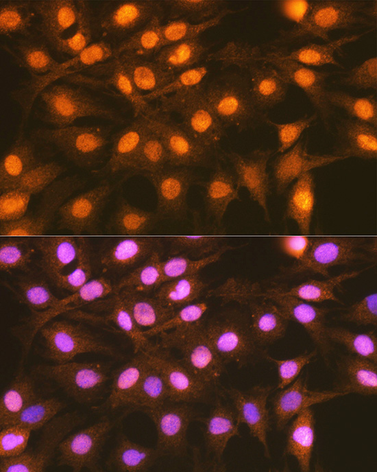 Immunofluorescence analysis of C6 cells using FANCD2 Polyclonal Antibody at dilution of 1:100 (40x lens). Blue: DAPI for nuclear staining.