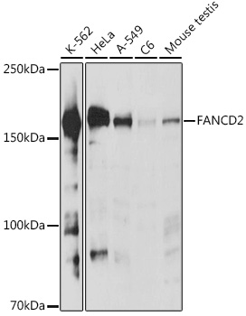 Western blot analysis of extracts of various cell lines using FANCD2 Polyclonal Antibody at 1:1000 dilution.