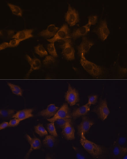 Immunofluorescence analysis of C6 cells using GJA8 Polyclonal Antibody at dilution of 1:100. Blue: DAPI for nuclear staining.