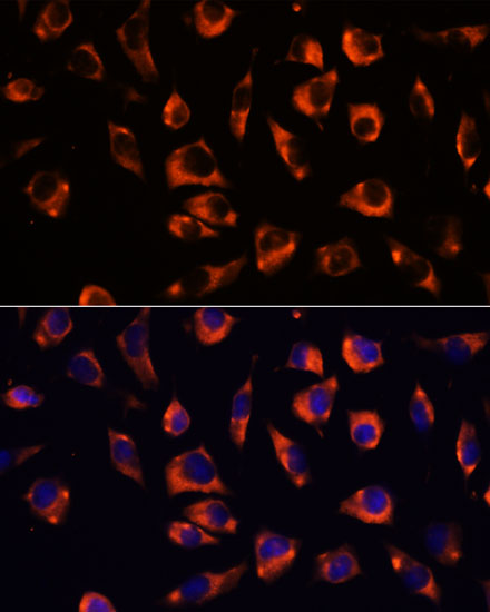 Immunofluorescence analysis of L929 cells using GRID2 Polyclonal Antibody at dilution of 1:100. Blue: DAPI for nuclear staining.