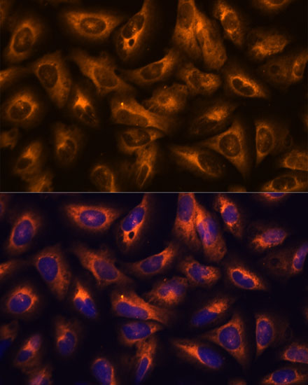 Immunofluorescence analysis of U2OS cells using GRID2 Polyclonal Antibody at dilution of 1:100. Blue: DAPI for nuclear staining.