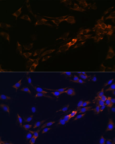 Immunofluorescence analysis of C6 cells using IL13RA2 Polyclonal Antibody at dilution of 1:100. Blue: DAPI for nuclear staining.