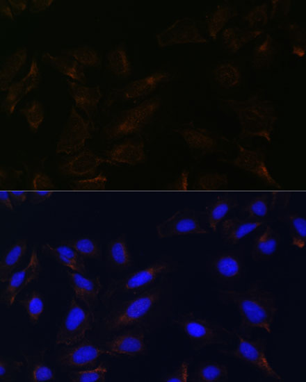 Immunofluorescence analysis of U2OS cells using IL13RA2 Polyclonal Antibody at dilution of 1:100. Blue: DAPI for nuclear staining.