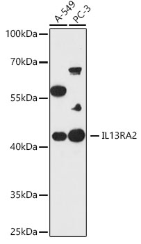 Western blot analysis of extracts of various cell lines using IL13RA2 Polyclonal Antibody at 1:1000 dilution.