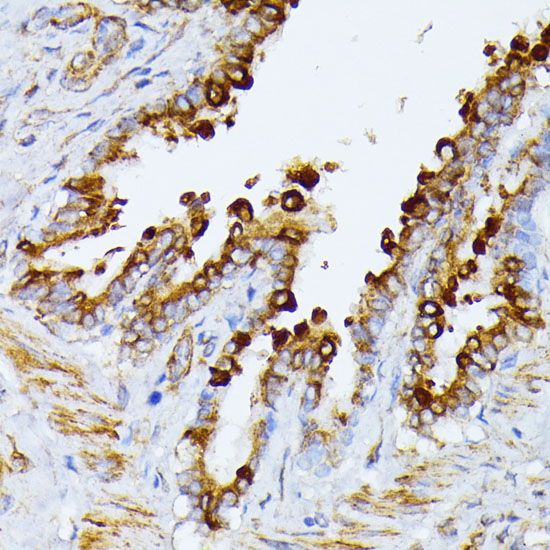 Immunohistochemistry of paraffin-embedded rat lung using ITPR2 Polyclonal Antibody at dilution of 1:100 (40x lens).Perform microwave antigen retrieval with 10 mM PBS buffer pH 7.2 before commencing with IHC staining protocol.