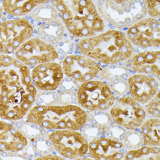 Immunohistochemistry of paraffin-embedded mouse kidney using ITPR2 Polyclonal Antibody at dilution of 1:100 (40x lens).Perform microwave antigen retrieval with 10 mM PBS buffer pH 7.2 before commencing with IHC staining protocol.