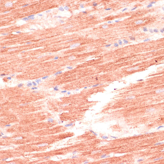 Immunohistochemistry of paraffin-embedded rat heart using MARK3 Polyclonal Antibody at dilution of 1:100 (40x lens).Perform microwave antigen retrieval with 10 mM PBS buffer pH 7.2 before commencing with IHC staining protocol.