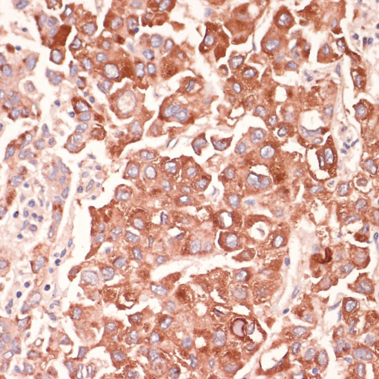 Immunohistochemistry of paraffin-embedded mouse kidney using MARK3 Polyclonal Antibody at dilution of 1:100 (40x lens).Perform microwave antigen retrieval with 10 mM PBS buffer pH 7.2 before commencing with IHC staining protocol.