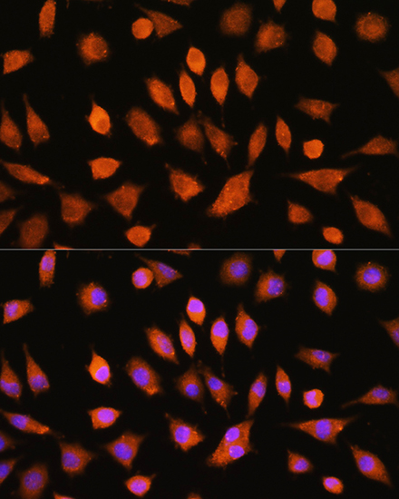 Immunofluorescence analysis of L929 cells using PI4KA Polyclonal Antibody at dilution of 1:100. Blue: DAPI for nuclear staining.