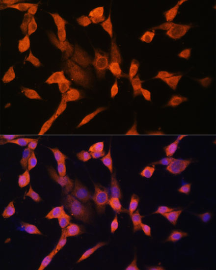 Immunofluorescence analysis of NIH/3T3 cells using PRKAR1A Polyclonal Antibody at dilution of 1:100. Blue: DAPI for nuclear staining.