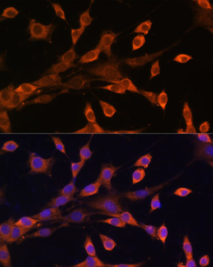 Immunofluorescence analysis of NIH/3T3 cells using PRKAR1A Polyclonal Antibody at dilution of 1:100. Blue: DAPI for nuclear staining.